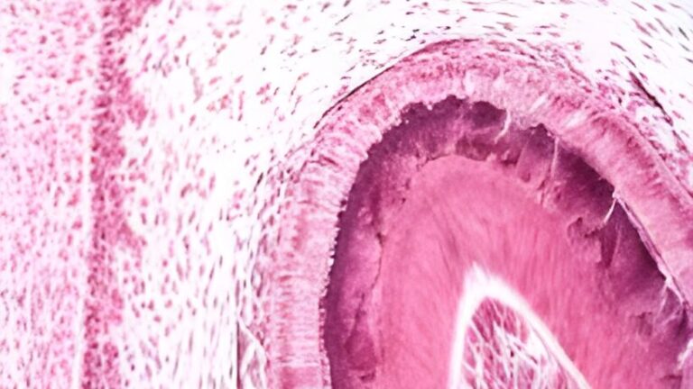 .Ameloblasty, to wyspecjalizowane komórki, które odgrywają kluczową rolę w tworzeniu szkliwa zęba. Ich brak może stanowić poważny problem