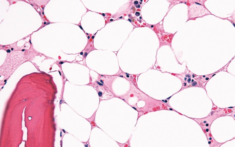 Aplazja to wrodzony brak zawiązka zęba. Sprawdź przyczyny, objawy i możliwości leczenia w nowoczesnej klinice.