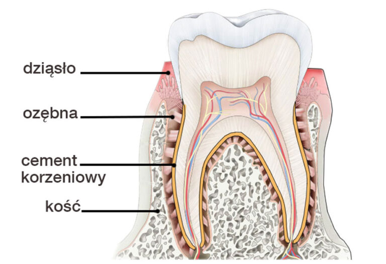 Czym jest cementoida i dlaczego wpływa na stabilność zęba? Poznaj jej rolę w leczeniu periodontologicznym.