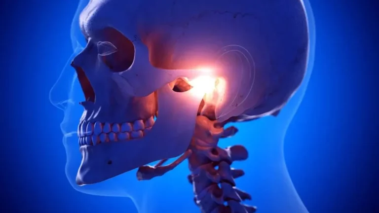 Dysfunkcja stawu skroniowo-żuchwowego (TMD) powoduje ból i trzaski żuchwy. Sprawdź objawy, przyczyny i leczenie w klinice.