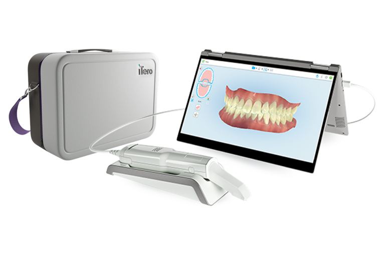Skanowanie wewnątrzustne to cyfrowy wycisk 3D bez dyskomfortu. Sprawdź, jak działa w klinice stomatologicznej.
