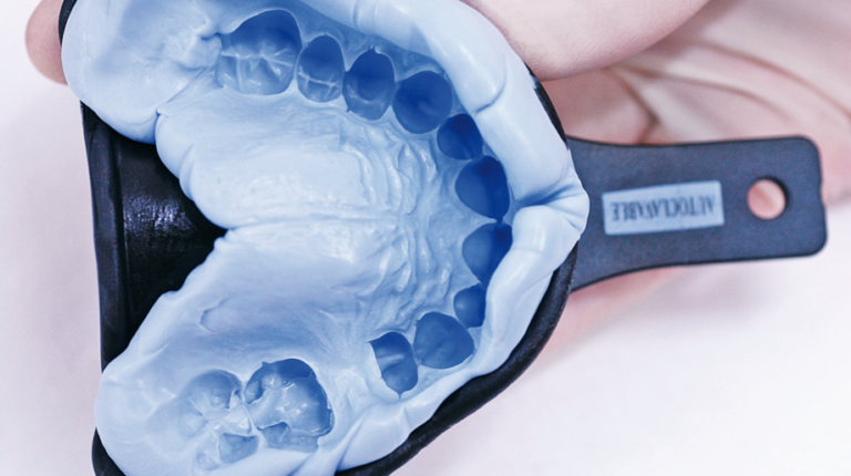 Alginian to popularny materiał do pozyskiwania wycisków. Poznaj jego zastosowanie w leczeniu protetycznym i ortodontycznym.