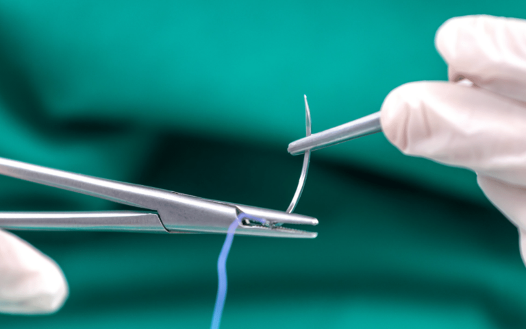 Katgut to wchłanialny materiał chirurgiczny stosowany do szwów w stomatologii. Sprawdź jego zastosowanie i właściwości.